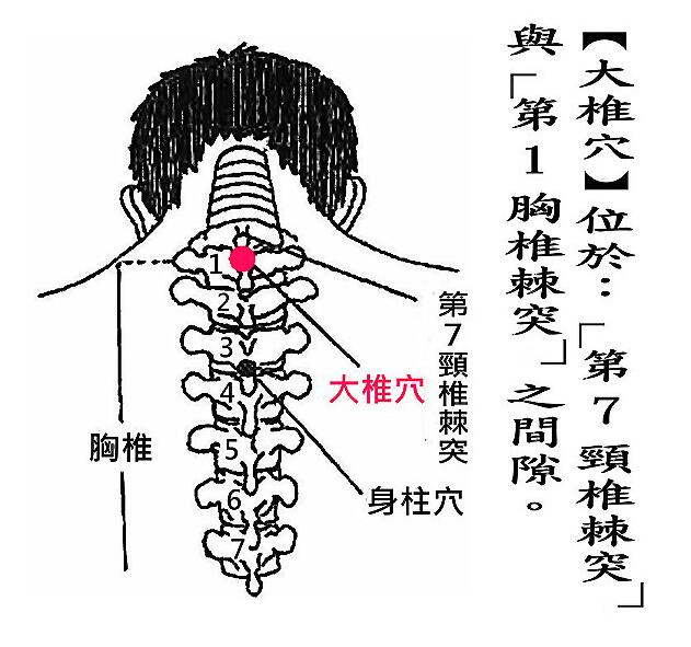 大椎的准确位置图和作用