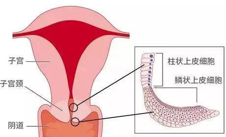 宫颈颜色发紫是宫寒吗