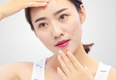 宫寒额头长痘痘吗