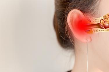 中耳炎分为哪几种类型