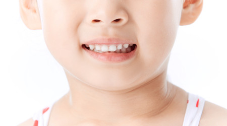 寶寶牙齒蛀牙應如何護理