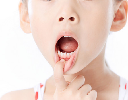 儿童蛀牙发炎怎么止疼