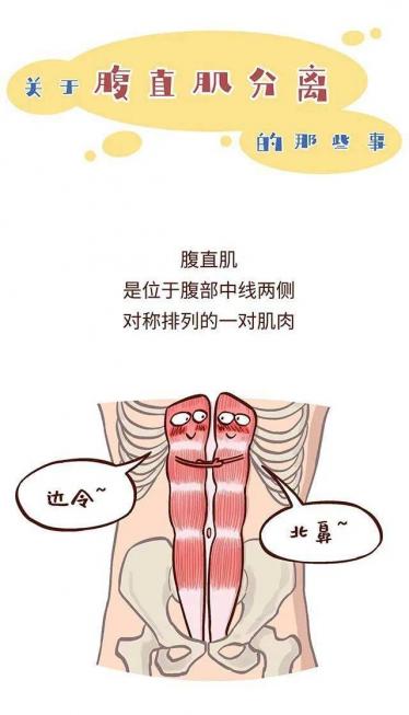 腹直肌分离怎么恢复训练 不练可能会被认为怀孕哦