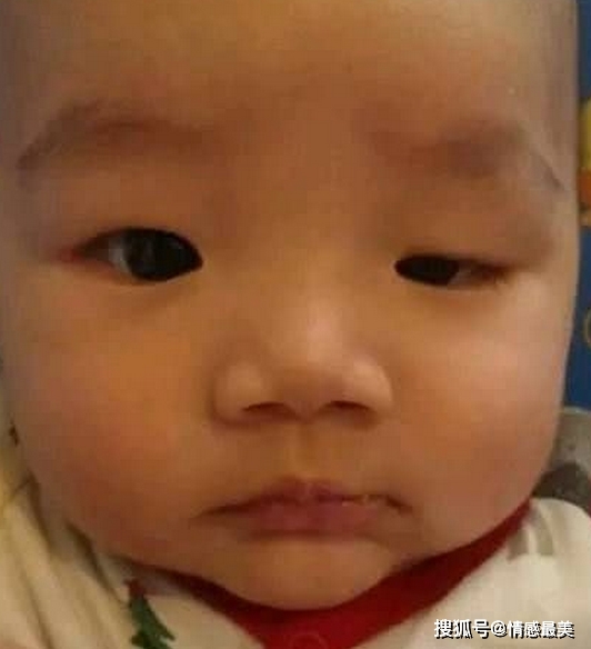 宝宝眼睛一大一小，父母带他去医院检查，见到舅舅后，大夫笑喷了