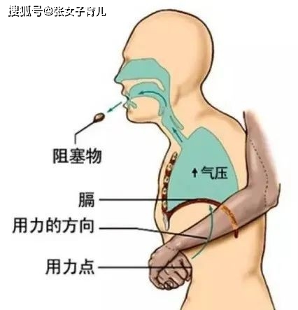 一顆糖引發的危機,家有3歲內的寶寶,海姆立克法急救法不可不會