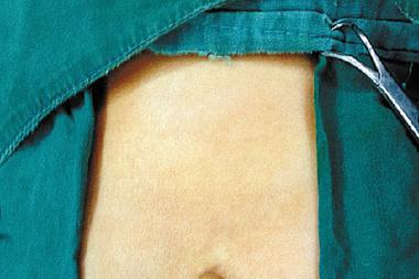 女婴屁股上长尾巴 易生畸形儿的11种女性