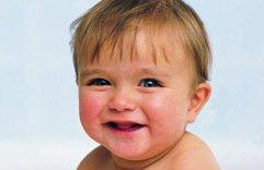新生儿常有眼屎是怎么回事？
