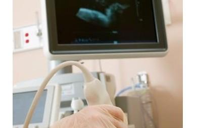 孕期B超单怎么看