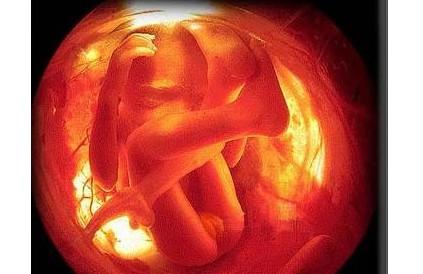 胎儿的哪些因素会导致难产