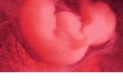 怀孕1个月胎儿的发育状况