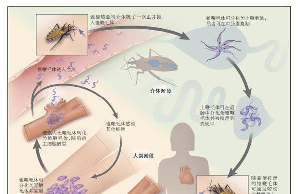 美洲暴发的“查加斯病”正全球蔓延，如何应对这种“新型艾滋病”