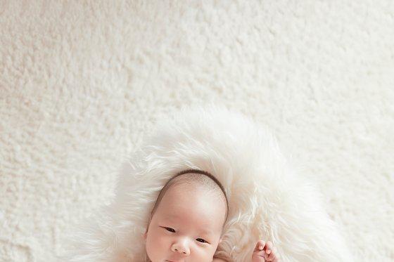 新生儿身上有小红点