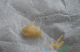 合生元奶粉 合生元孕妇奶粉现不明胶状物