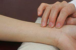 产后风湿病怎么治疗