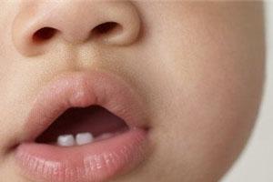 宝宝出牙五大注意项