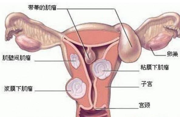 子宫内膜增厚是什么原因?