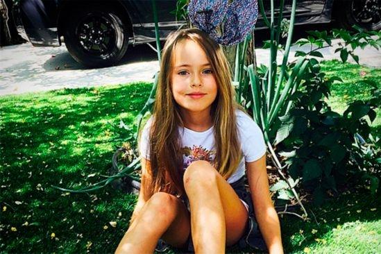 左侧精索静脉曲张轻重判断