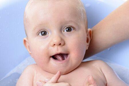 宝宝有了奶瓶齿怎么办