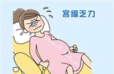 什么是宫缩乏力 宫缩乏力是怎样引起的