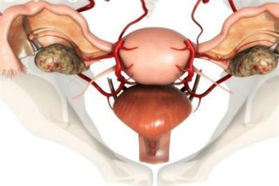 产褥感染三大主要症状有哪些？