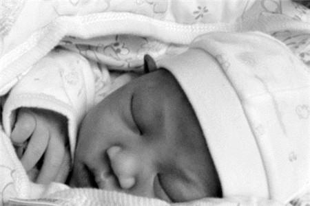 羊水栓塞怎么预防