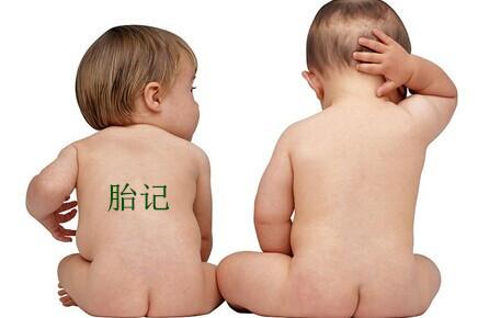 青色胎记形成的原因