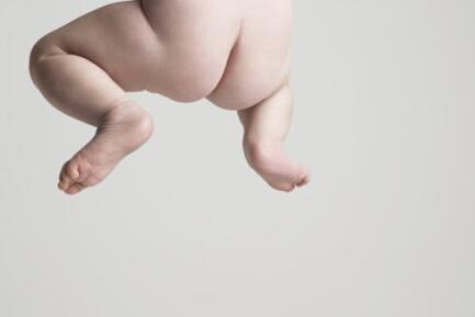 宝宝红屁屁偏方大全