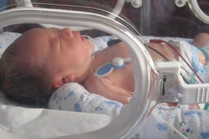 新生儿窒息是什么意思