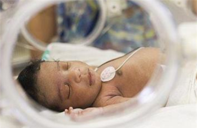 新生儿窒息后遗症表现