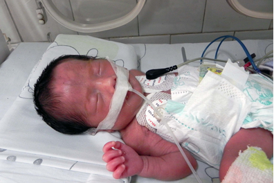 新生儿窒息抢救措施