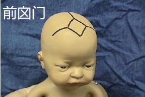 囟门早闭的原因