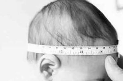 婴儿囟门大小标准