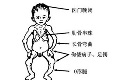 囟门大是什么原因