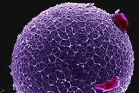 男士无精怎么办 无精治疗方法全解