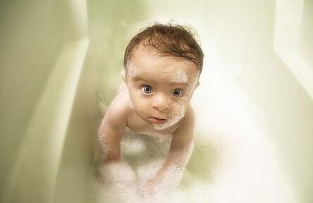 宝宝烫伤多久能洗澡 宝宝烫伤后洗澡不能忽视的要点