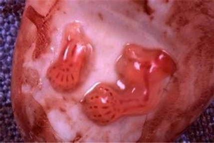 早孕流产与月经的区别有哪些 这些不同之处一定有你不知道的