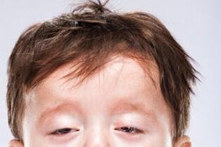 宝宝异物咳嗽的症状 孩子咳嗽竟是支气管异物