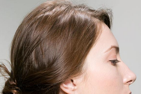 宝宝奶粉过敏怎么转奶 给过敏宝宝转奶要注意方法