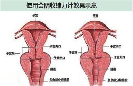 产后下面松弛怎么办