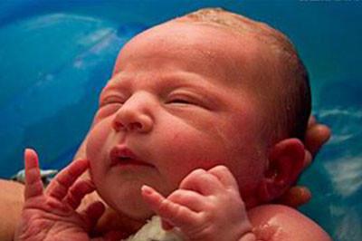 婴儿乳痂会自行脱落吗