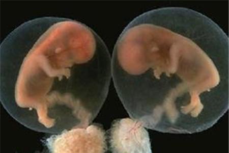 葡萄胎多久能发现