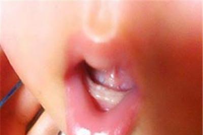 婴儿为什么长马牙？
