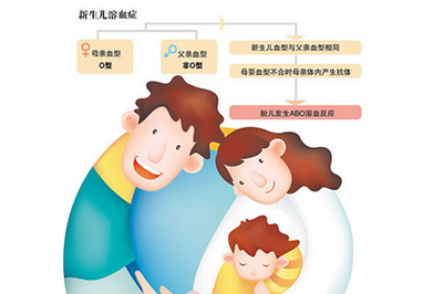 新生儿溶血症可以治愈吗？