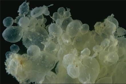 葡萄胎几率是多少