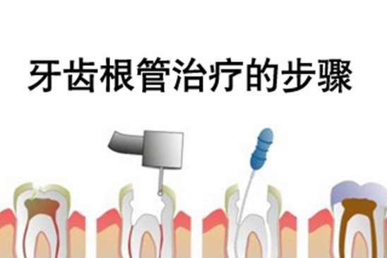 儿童做根管治疗怎么做的？