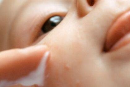 小孩食物过敏多久就好？