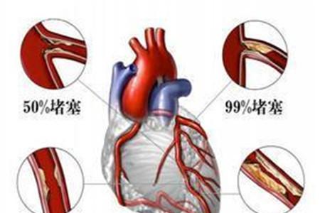 围产期心肌病诊断标准