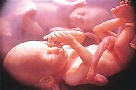 怀孕21周可以做四维吗