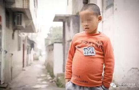 全球罕见怪病盘点：孩子一笑就骨折