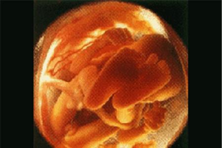 怀孕24周羊水正常值是多少